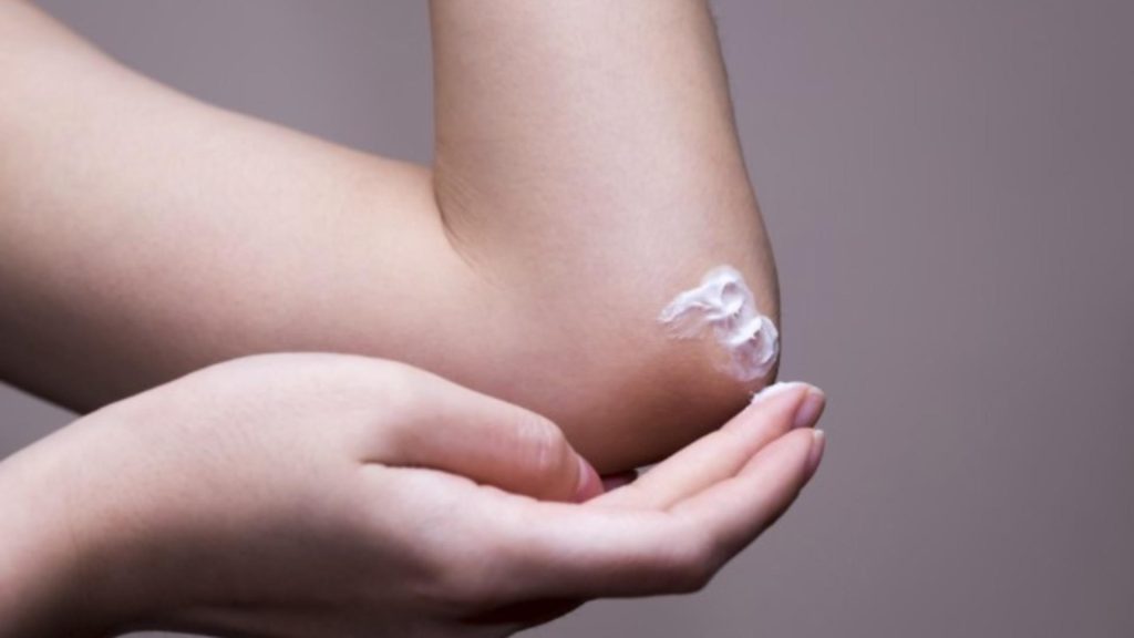 Ce înseamnă dacă ai coatele mai închise la culoare. 5 substanțe la îndemână care te scapă de această problemă