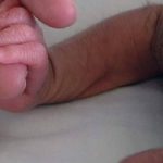 Scandal în Spania: tot mai mulți bebeluși suferă de sindromul vârcolacului. Ce substanță se face vinovată