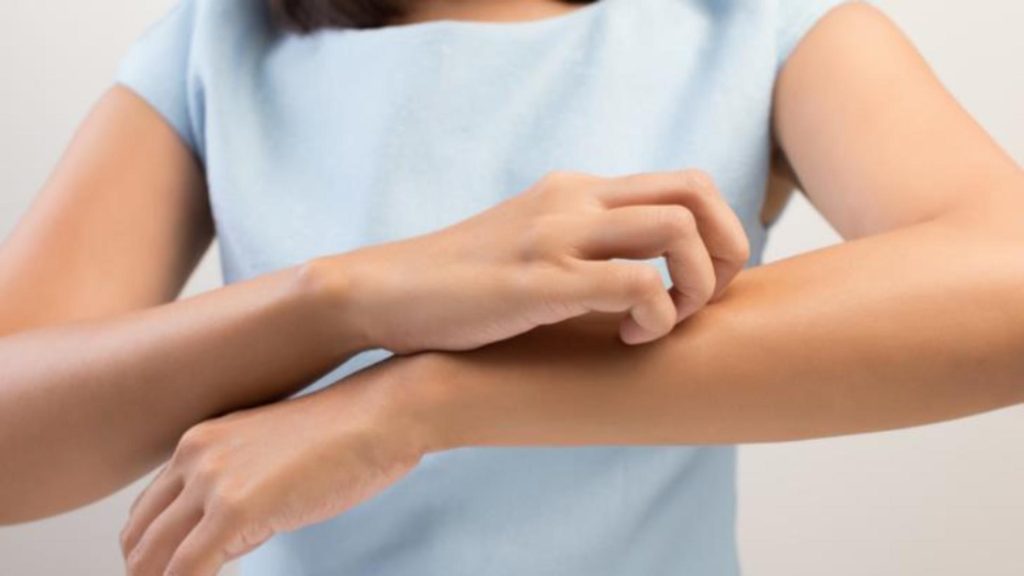 Dacă ai erupții cutanate iar dermatologii ridică din umeri ar putea fi vorba de alergie la o substanță alimentară. Explicațiile unui nutriționist