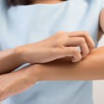 Dacă ai erupții cutanate iar dermatologii ridică din umeri ar putea fi vorba de alergie la o substanță alimentară. Explicațiile unui nutriționist