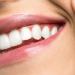 Cum să îți albești dinții în mod natural, folosindd doar produse la îndemâna oricui. Remedii care îți conferă un zâmbet de invidiat