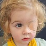 Caz șocant: un băiat, de doi ani, a rămas fără vedere după ce a fost sărutat de o persoană cu herpes