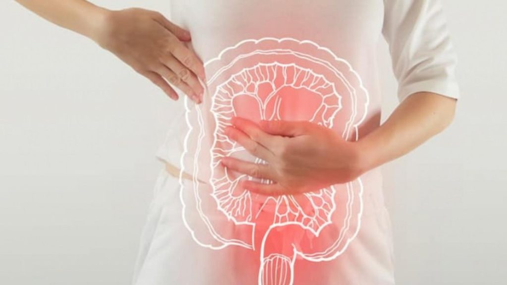 De ce este în creștere numărul cazurilor de cancer de colon la tineri: care sunt semnele subtile de avertizare. Dieta care reduce riscul