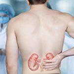 Cum poți preveni apariția pietrelor la rinichi. Ce recomandă specialiștii pentru a evita această afecțiune