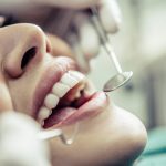 Semnele Ignorate ale Sănătății Dentare: Când Este Momentul Să Vizitezi Dentistul