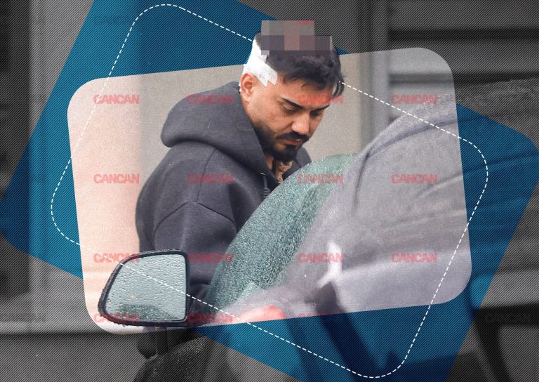 Transformarea lui Jador: Între estetică și emoții – O privire detaliată asupra intervențiilor artistului