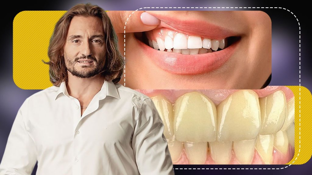 Albirea Naturală a Dinților: Perspective și Recomandări ale Dr. Cezar despre Sănătatea Dentară