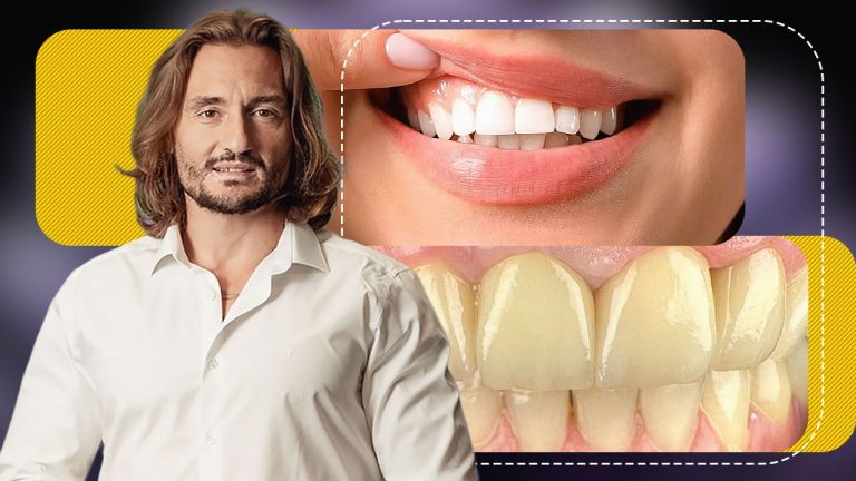 Albirea Naturală a Dinților: Perspective și Recomandări ale Dr. Cezar despre Sănătatea Dentară