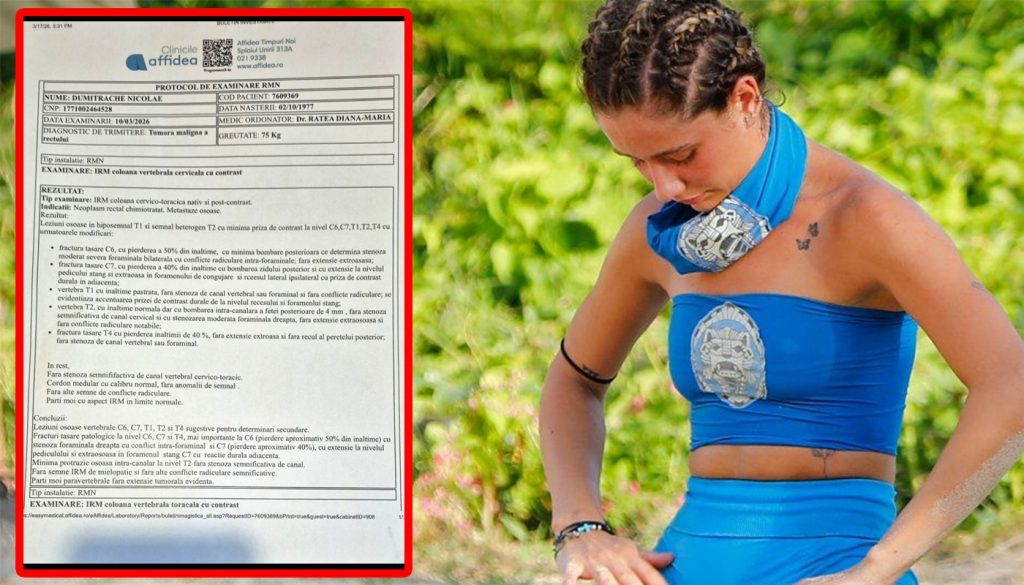 Întoarcerea acasă a Biancăi Stoica de la Survivor: O poveste de curaj și provocări personale