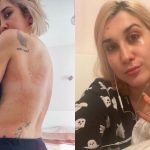 Căutarea disperată a unui diagnostic: Povestea Adda și lupta împotriva bolii Lyme
